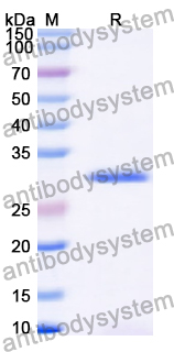 Recombinant Human MTX2 Protein, N-His