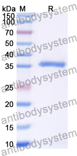 Recombinant Human CRLF1 Protein, N-His