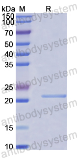 Recombinant Human PSIP1 Protein, N-His-SUMO