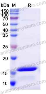 Recombinant Human ERLIN1 Protein, N-His