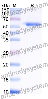 Recombinant Human TADA2A Protein, N-His