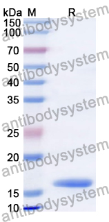 Recombinant Human SRSF10 Protein, N-His