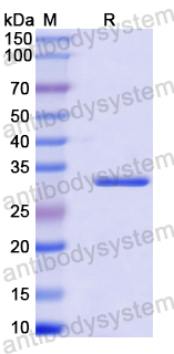 Recombinant Human CLN5 Protein, N-His