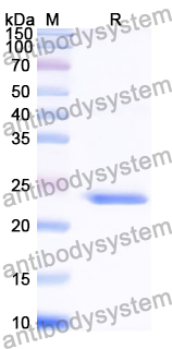 Recombinant Human TADA3 Protein, N-His