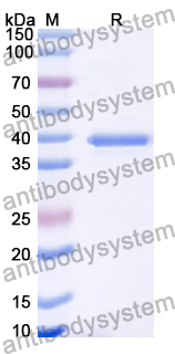 Recombinant Human TAF5L Protein, N-His