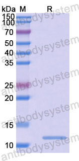 Recombinant Human CSDE1 Protein, N-His