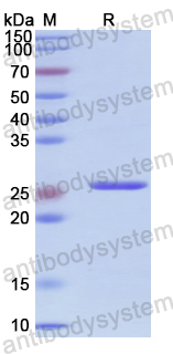 Recombinant Human SKAP2 Protein, N-His-SUMO & C-Strep