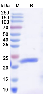 Recombinant Human PRKRA Protein, N-His