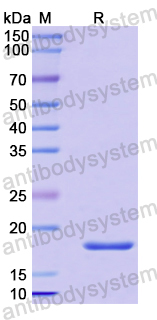 Recombinant Human CRCP Protein, N-His