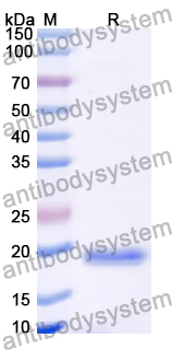 Recombinant Human MED6 Protein, N-His