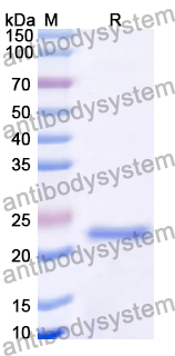 Recombinant Human GCM2 Protein, N-His