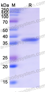 Recombinant Human USP2 Protein, N-His