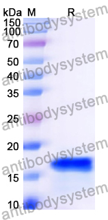 Recombinant Human DEDD Protein, N-His