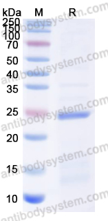 Recombinant Human UPK3A Protein, N-His