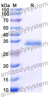 Recombinant Human CTAG2 Protein, N-GST & C-His