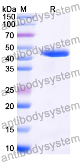 Recombinant Human PPM1B Protein, N-His