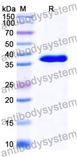 Recombinant Human RP2 Protein, N-His