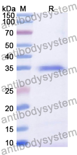 Recombinant Human WDHD1 Protein, N-His