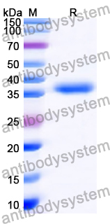Recombinant Human SLC25A12 Protein, N-His