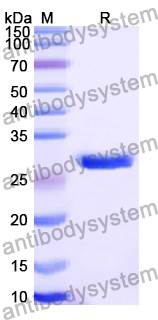 Recombinant Human RAD51D Protein, N-His