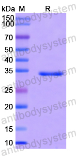 Recombinant Human PPP1R15A Protein, N-GST & C-His