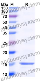 Recombinant Human EIF3J Protein, N-His
