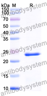 Recombinant Human CIB2 Protein, N-His
