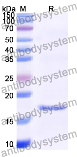 Recombinant Human FACE1/ZMPSTE24 Protein, N-His