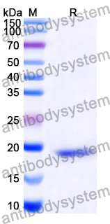 Recombinant Human TRAPPC6A Protein, N-His