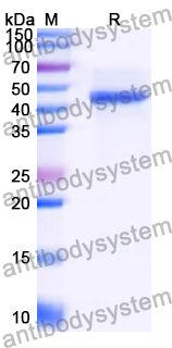 Recombinant Human ATRN/Attractin Protein, N-His