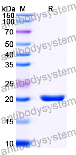 Recombinant Human RBBP9 Protein, N-His