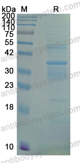 Recombinant Human SOAT2 Protein, N-His-KSI