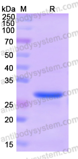 Recombinant Human DHRS3 Protein, N-His