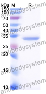 Recombinant Human PIAS2 Protein, N-His