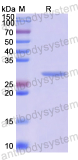 Recombinant Human BCAS2 Protein, N-His