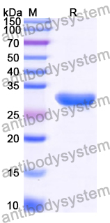 Recombinant Human RAD17 Protein, N-His