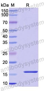 Recombinant Human AKAP3 Protein, N-His