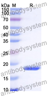 Recombinant Human SASH3 Protein, N-His