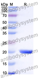 Recombinant Human KRT36 Protein, N-His