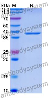 Recombinant Human CIAO1 Protein, N-His
