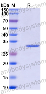 Recombinant Human RECQL4 Protein, N-His