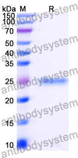 Recombinant Human RECQL5 Protein, N-His
