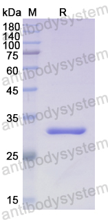 Recombinant Human B3GAT3 Protein, N-His