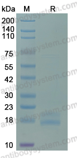 Recombinant Human DRAK2/STK17B Protein, C-His