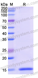 Recombinant Human USP1 Protein, N-His