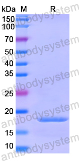 Recombinant Human UFL1 Protein, N-His