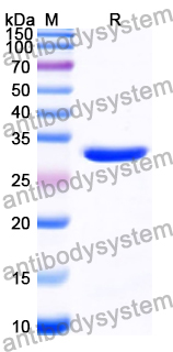 Recombinant Human PHF14 Protein, N-His