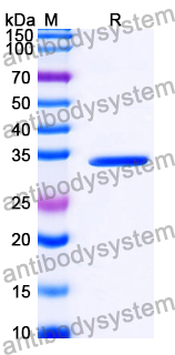 Recombinant Human LRIG2 Protein, N-His