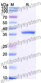 Recombinant Human TOX Protein, N-GST & C-His