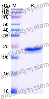 Recombinant Human UBOX5 Protein, N-His